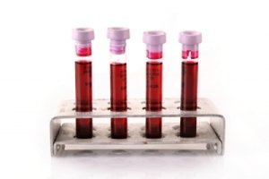 How to Read Your Liver Blood Test Results (Please read) - Part 2